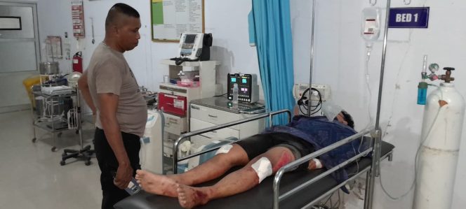 
					Dua Motor Saling Tabrakan, Satu Pengendara Luka Serius Dilarikan ke Rumah Sakit