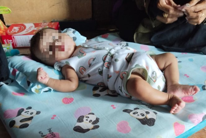 
					Miris Bayi di Luyo Terpaksa Minum Susu Campur Air Sumur Keruh